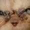 Apocrien hidrocystoma Pers Apocrien hidrocystoma Pers