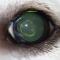 Cataract jonge Golden retriever