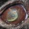 Neurogeen droog oog Neurogeen droog oog