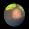 Optic neuritis hond Optic neuritis hond
